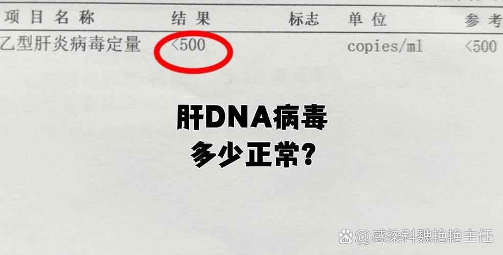 乙肝dna病毒多少算高
