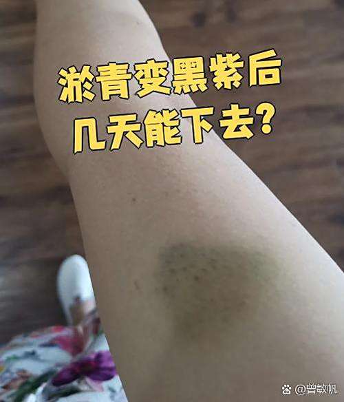 皮带打女生光屁股多少下会变紫青