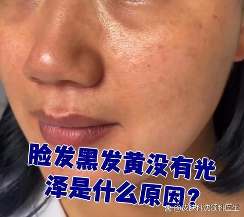 老化发黄是什么意思