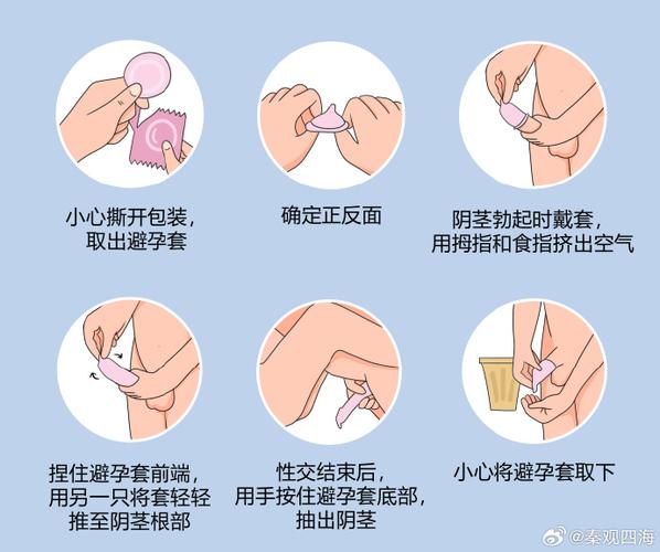 无安全套怎么避孕