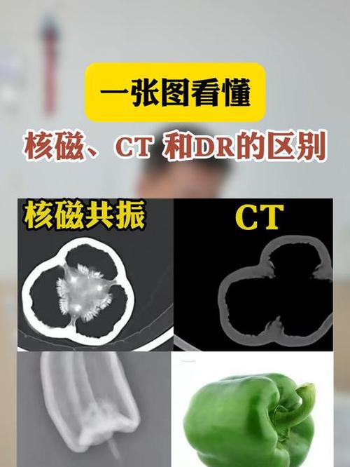 核磁比ct更清楚吗