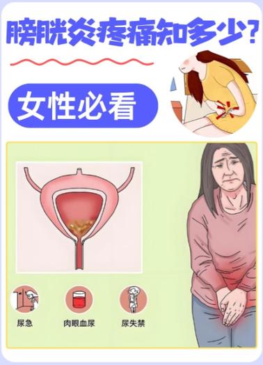 挤压膀胱排尿会有后遗症吗