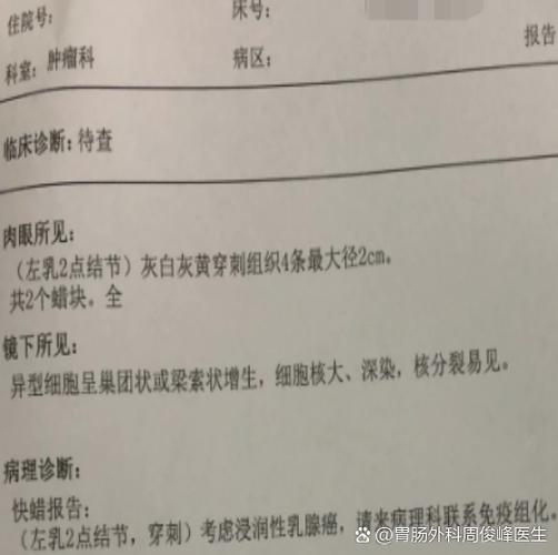 IB是癌症早期还是晚期