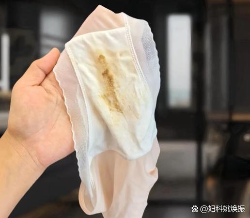 白带脏吗