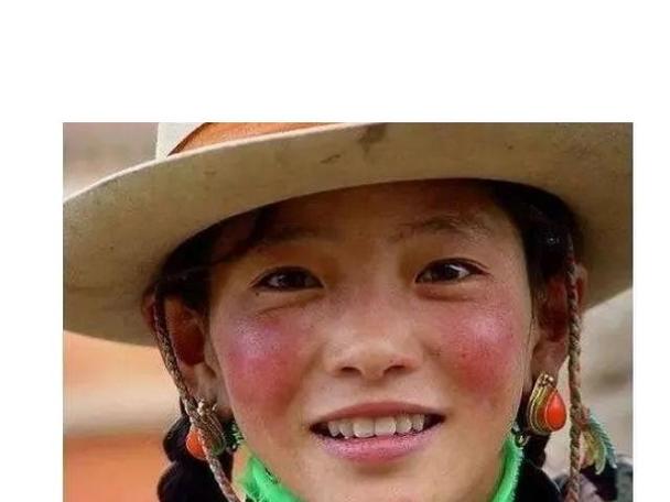 高原红脸蛋怎么修复