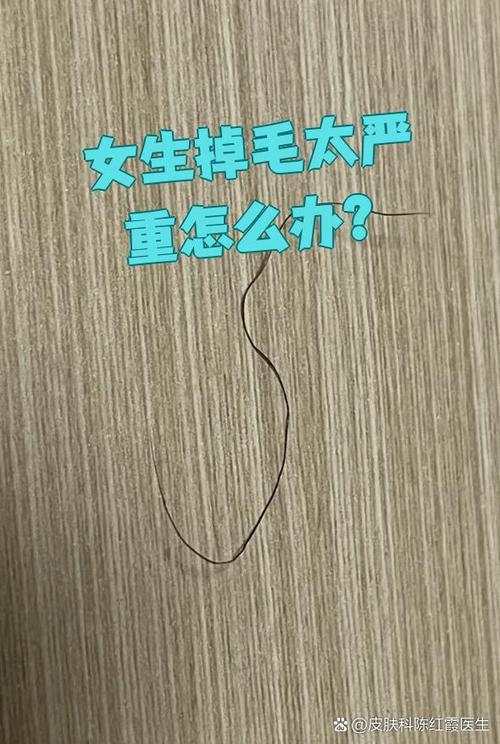 掉毛是什么意思?图标