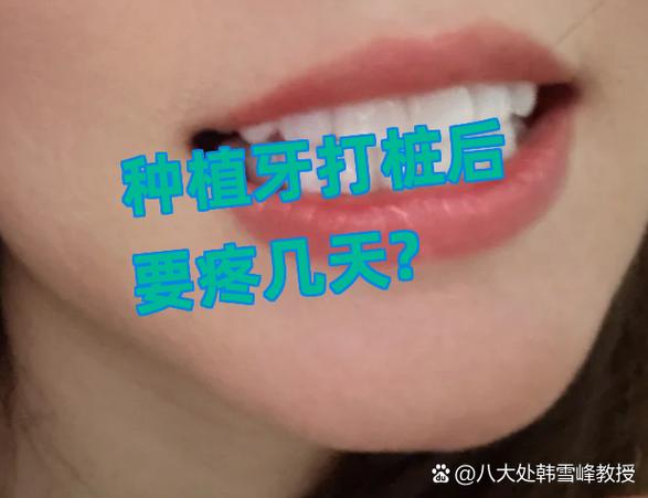 种植牙打桩后要疼几天