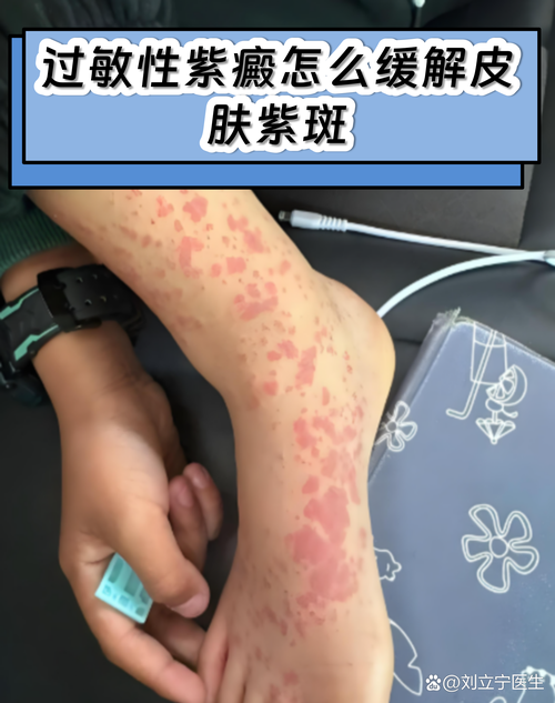 手机出现紫色斑点维修多少钱