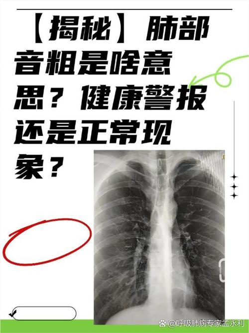 喘气粗是什么病的前兆