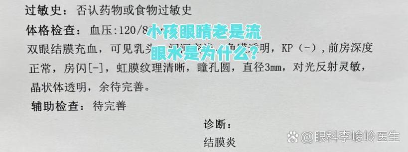 小孩眼睛总是流眼水图标