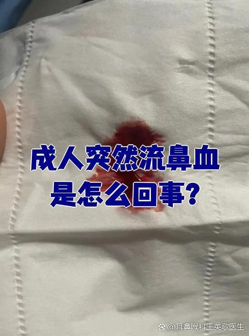流鼻血是怎么回事大人缩略图