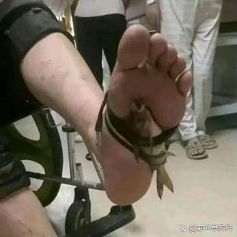 鲤鱼乡绑脚