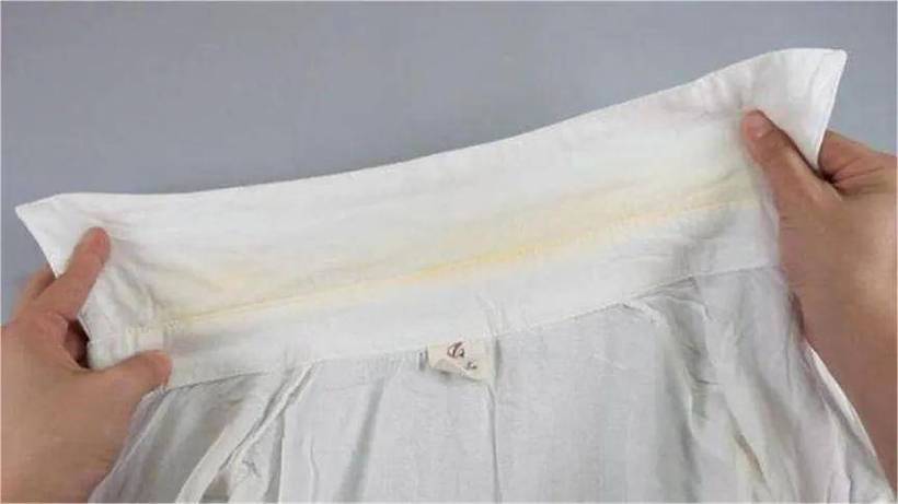 白色衣服领子发黄怎么洗白缩略图