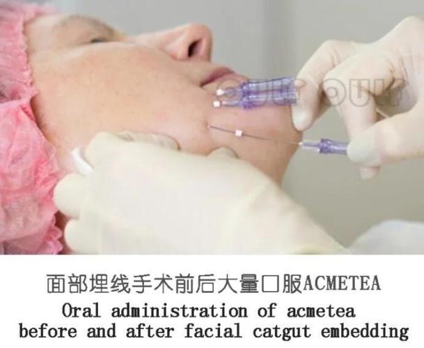 线雕能摸到线头怎么办