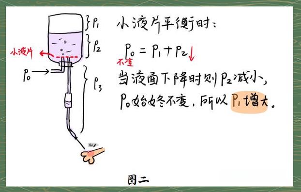 打吊瓶是什么原理图标
