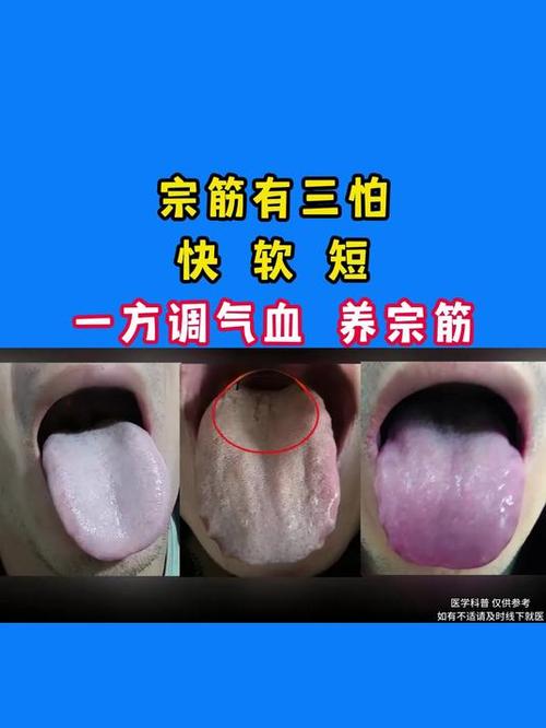 宗筋不硬是什么原因