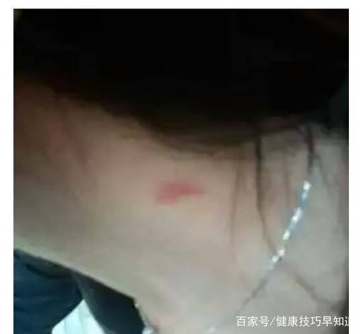 留草莓印的男人什么心理