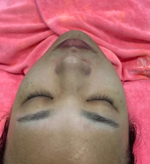 面部黑怎么变白