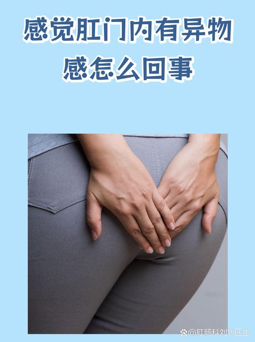 屁眼感觉有异物感怎么回事