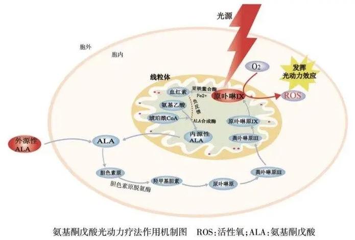 PDT治疗是什么意思