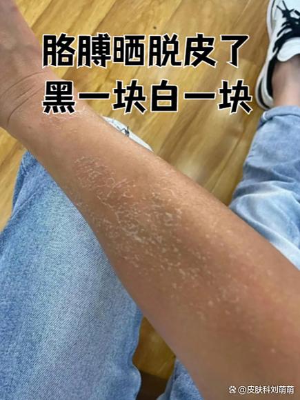 手机暴晒后如何补救