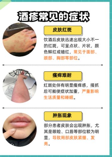 怎么知道自己对什么过敏