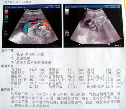 B超的报告电脑生成吗