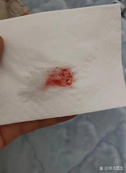 女性不咳嗽但有痰带血