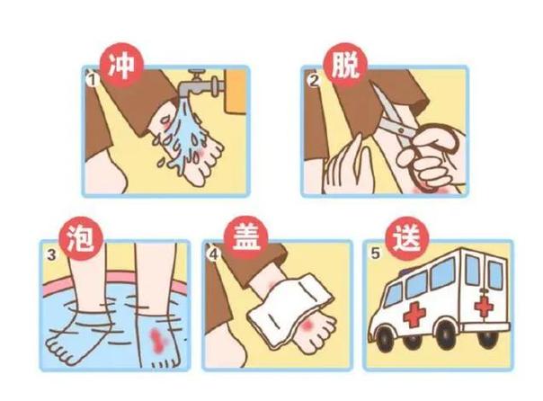烫伤后白色水泡