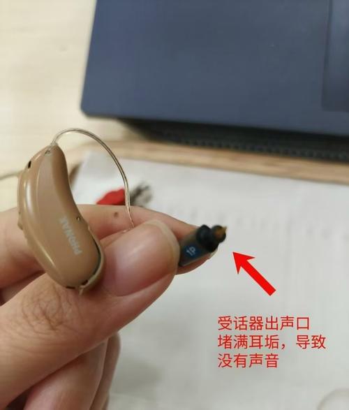 k20pro听筒脏了怎么清理