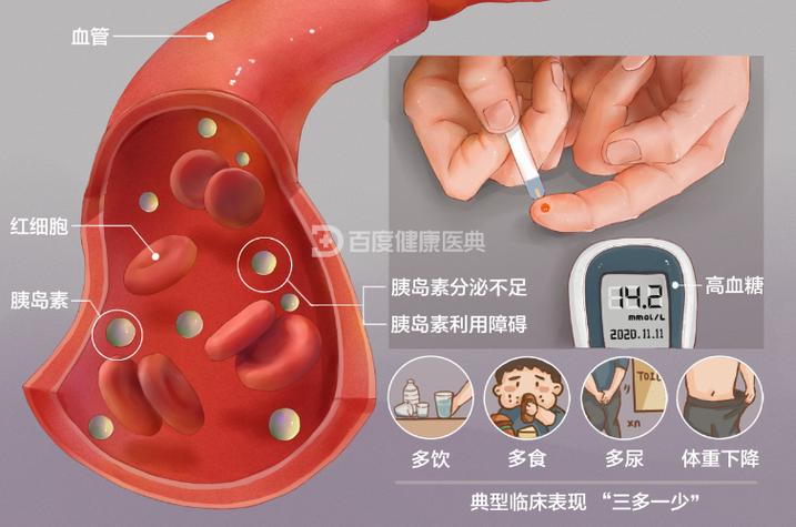 血糖高吃什么最好图标