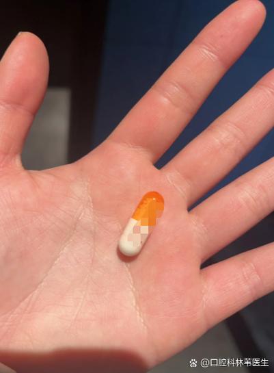 嘴巴挂钩一张嘴就响感觉错位