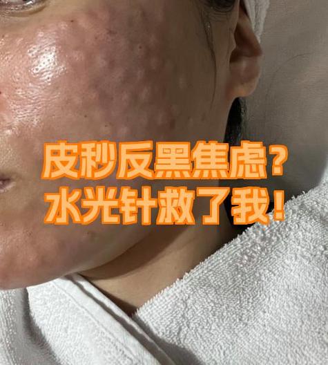 郑州祛斑最建议去的三个地方