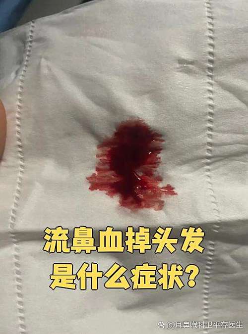 染完头发流鼻血为啥