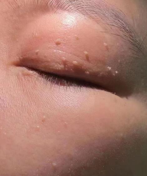 长小肉揪揪怎么回事图标