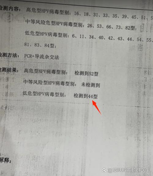 hpv44型阳性是怎么感染上的