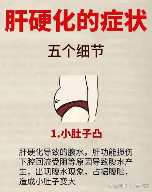 肝病的症状游戏截图