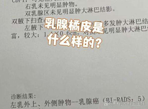 乳腺癌患者可以吃橘子吗图标