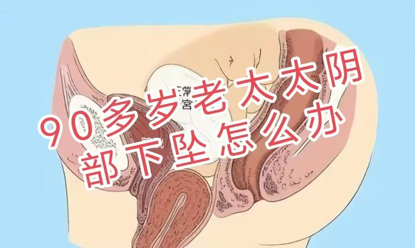下面总感觉下坠感怎么回事