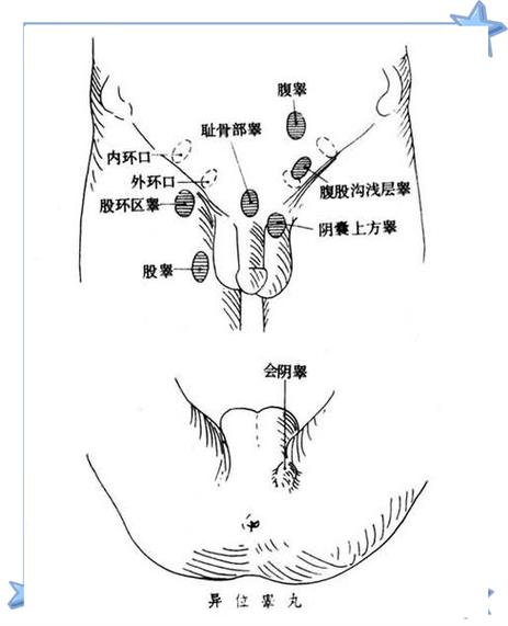 如何删除视频号的地理位置截图