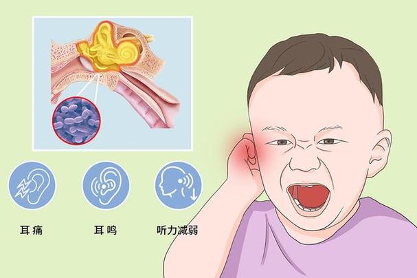 戴耳机耳鸣多久能恢复截图