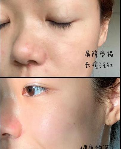 手机进水出现一条白光图标