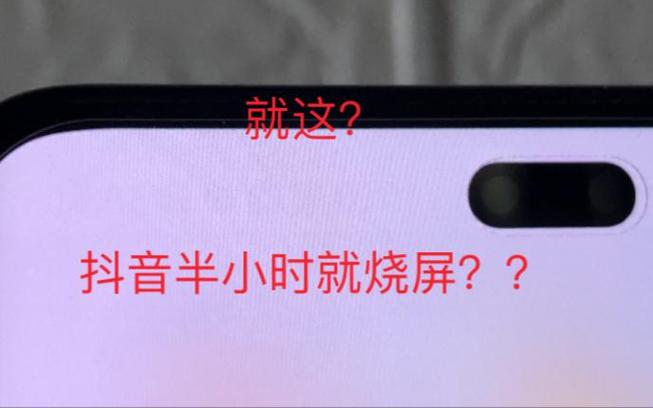 抖音烧屏在哪里设置