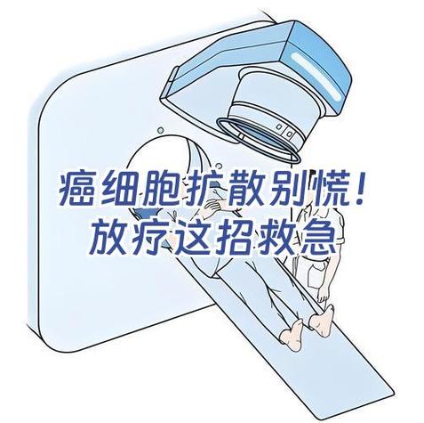 放疗30次报销完要多少钱截图