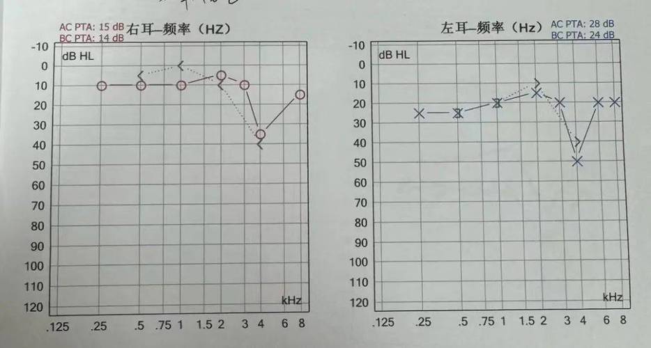 电测听力怎么能过去