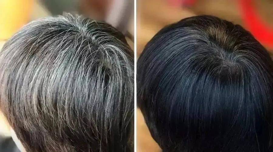 白头发变黑发实用方法图标