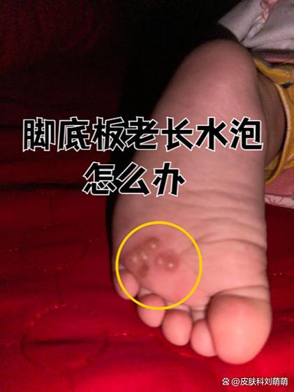 脚心抓痒固定脚