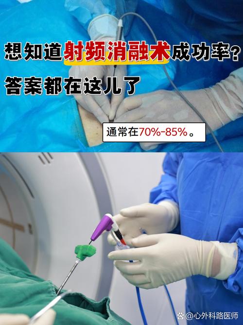 射频消融仪截图