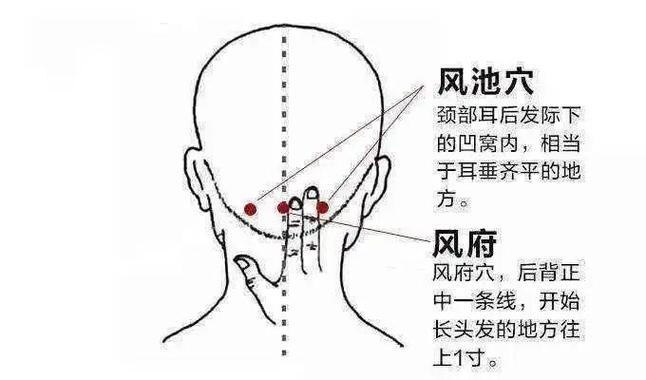 三风指哪三风