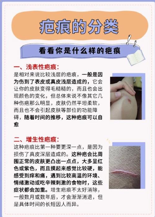磨皮能去除疤痕吗